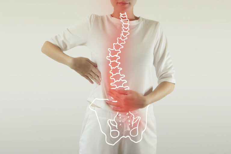 chiropractic for scoliosis rutherford, edmonton south